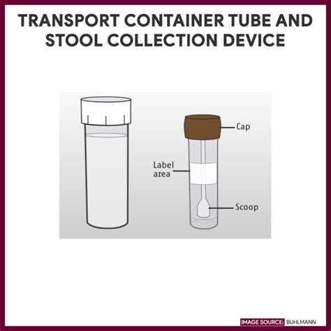 Routine Fecalysis Test (with sample stool and container).